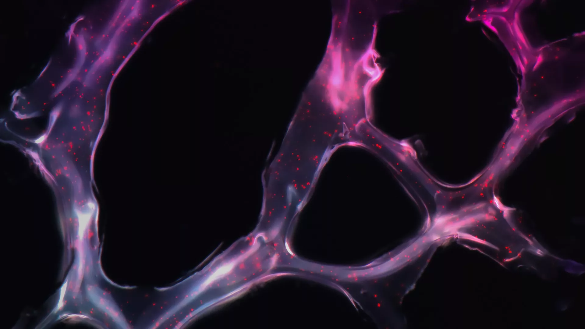 علماء ينجحون بمعالجة "الشلل التام" واستعادة المشي مجددا... فيديو وصور